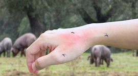 Mosquito bites on hand while being outdoors