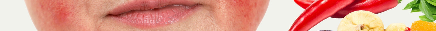 16 Common Foods That Trigger Rosacea Flare-Ups