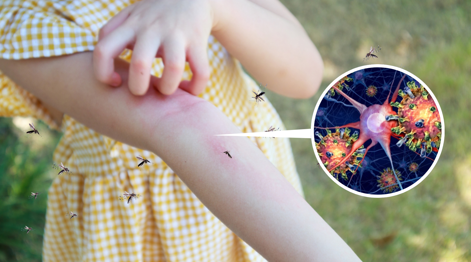 5 Mosquito-Borne Diseases in Australia: Symptoms, Risks & Prevention