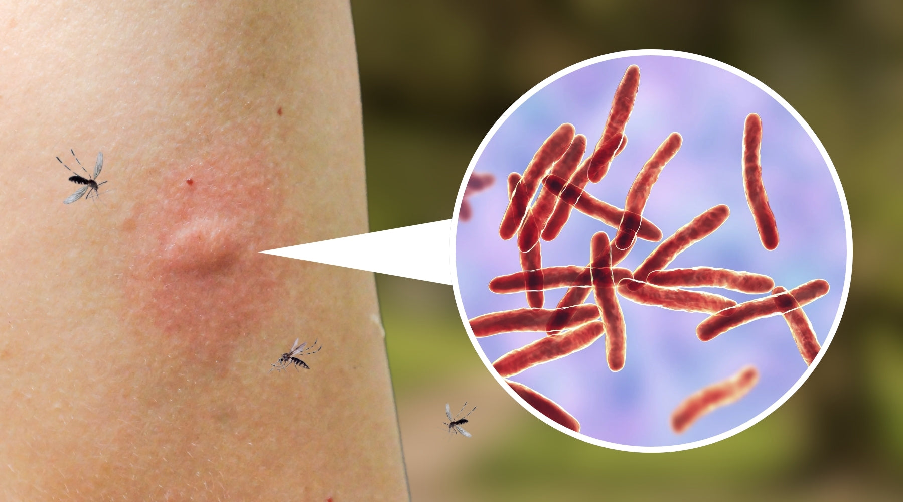 Buruli Ulcer: How Possum Poo & Mozzies Are Spreading The Flesh-Eating Disease