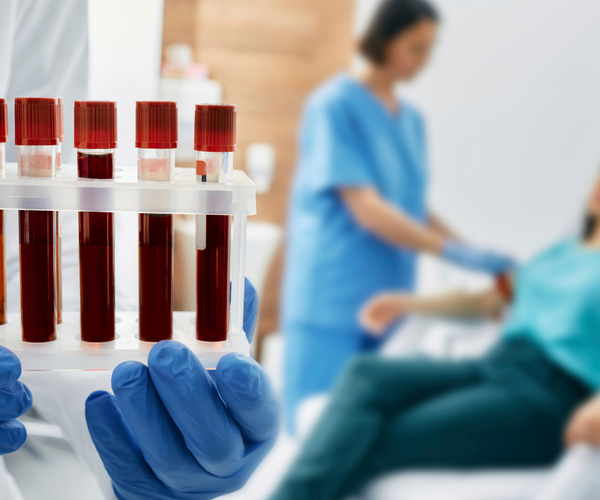 Check Your Iron Levels Blood Tests You Should Know About Aussie