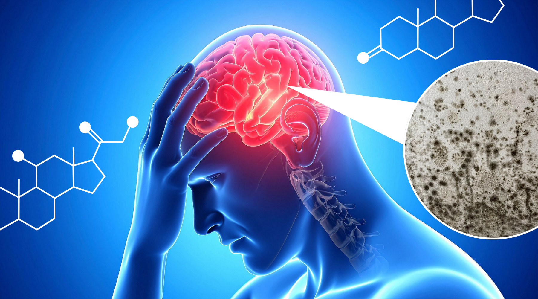 From Brain Fog to Fatigue: How Mould Toxicity Affects the Nervous System & Hormones