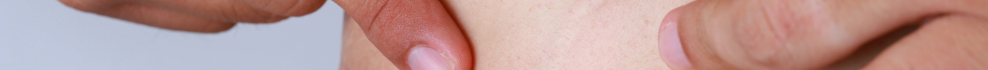 How to Get Rid of Stretch Marks without Medical Procedures