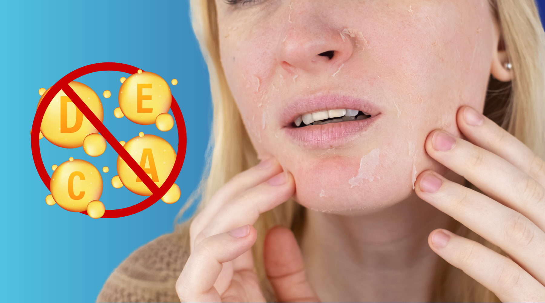 Is Your Dry Skin a Sign of a Vitamin Deficiency?
