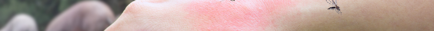 Japanese Encephalitis Risk Rises in Australia: How It Spreads & How to Stay Protected