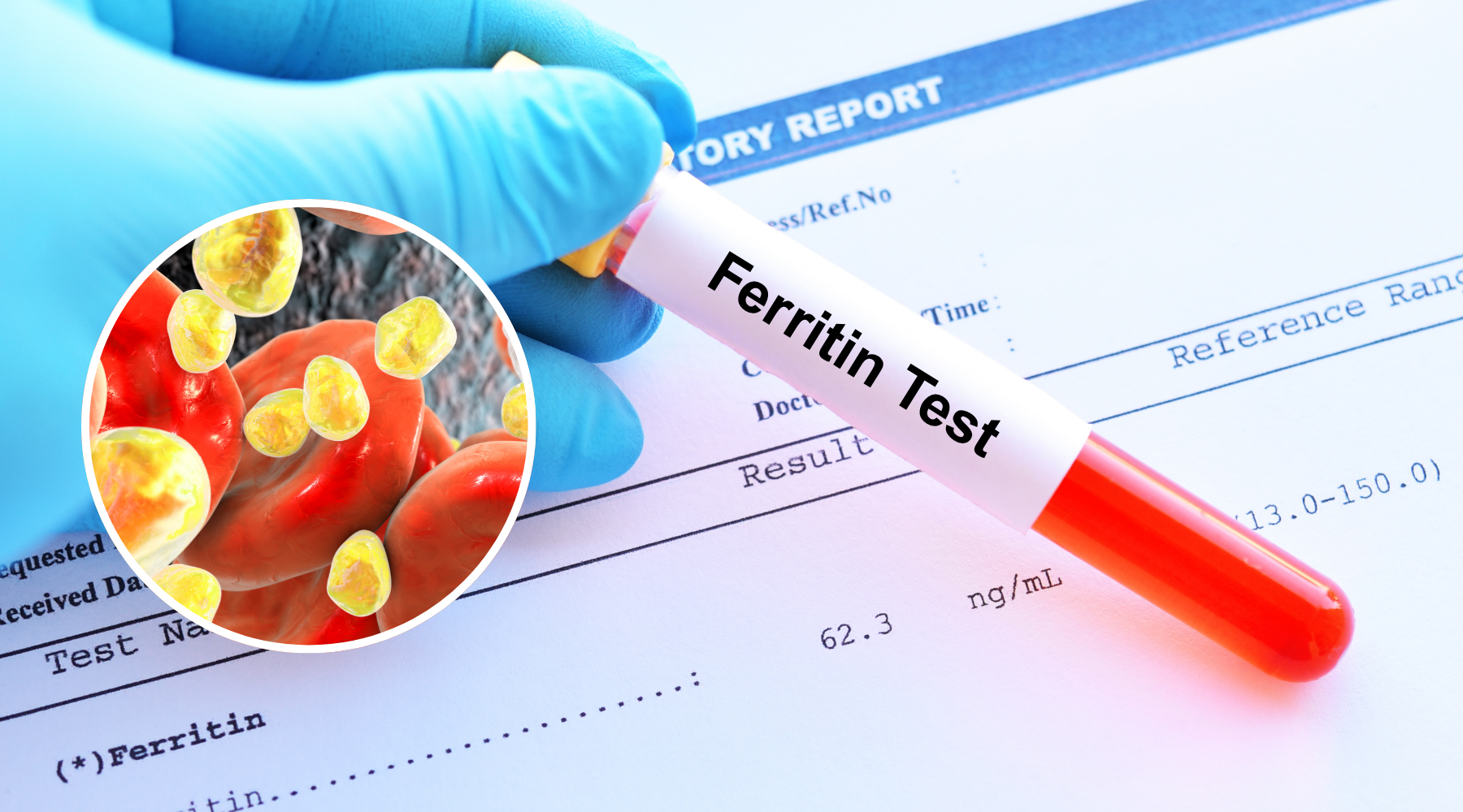 Low Ferritin, Normal Iron: What Your Blood Test Might Be Telling You