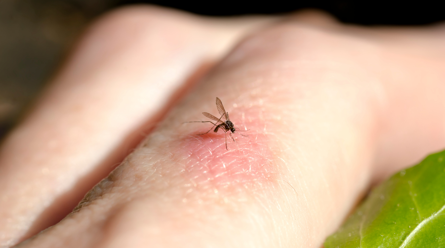 Mosquito Bites: How to Recognise & Treat Them Quickly Info Hidden