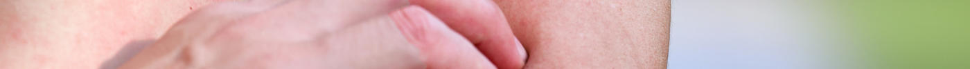 Red rashes that cause itchiness