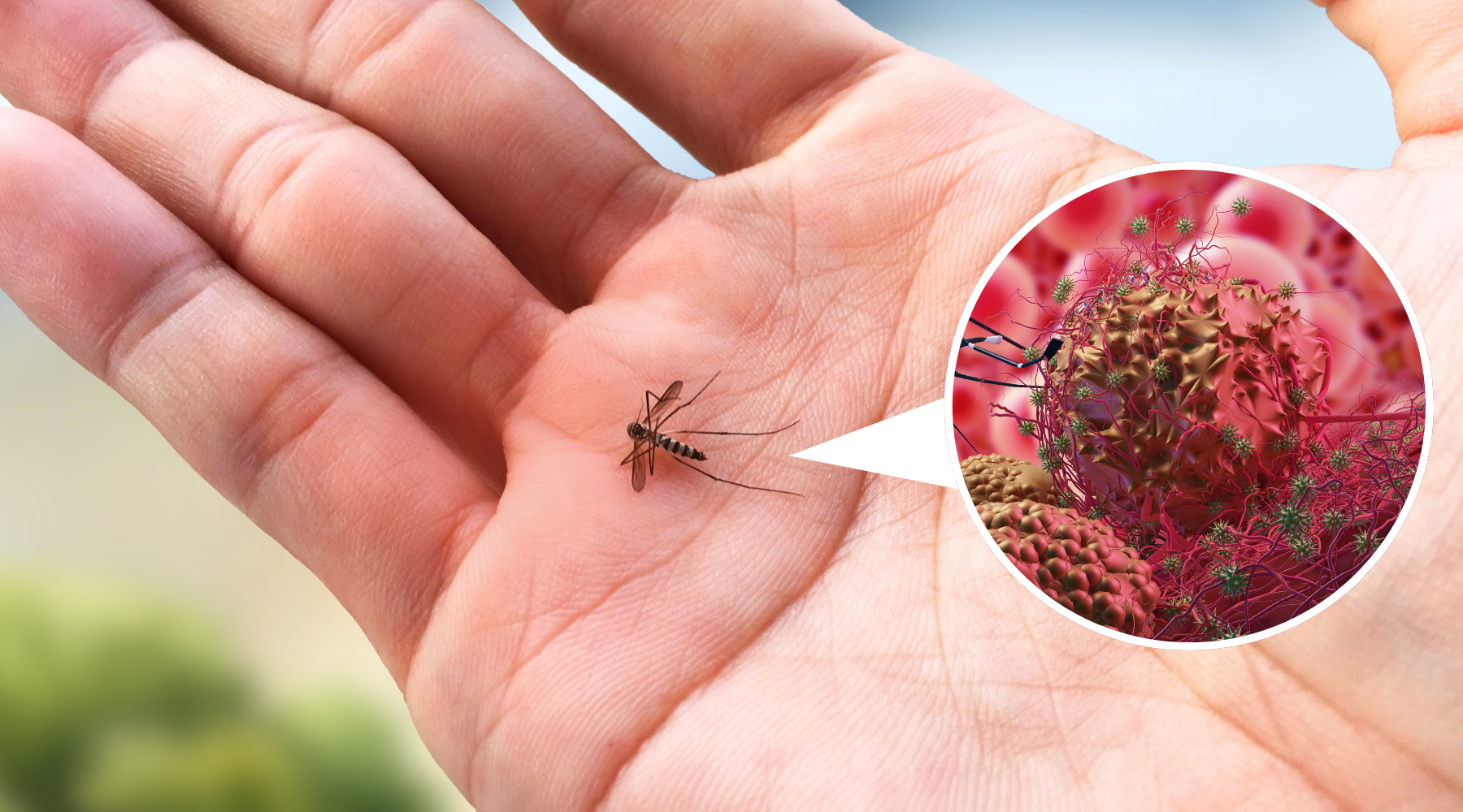 What Areas in Australia Are Most at Risk for Japanese Encephalitis?