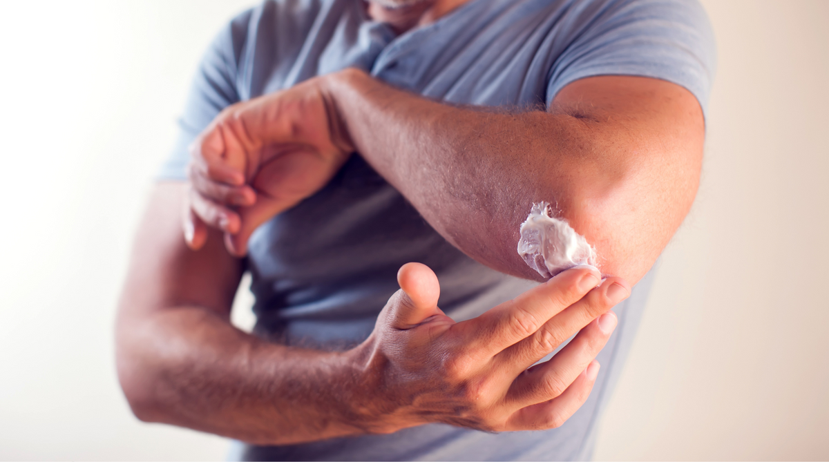 What is a Barrier Cream and How to Use It? – Aussie Pharma Direct