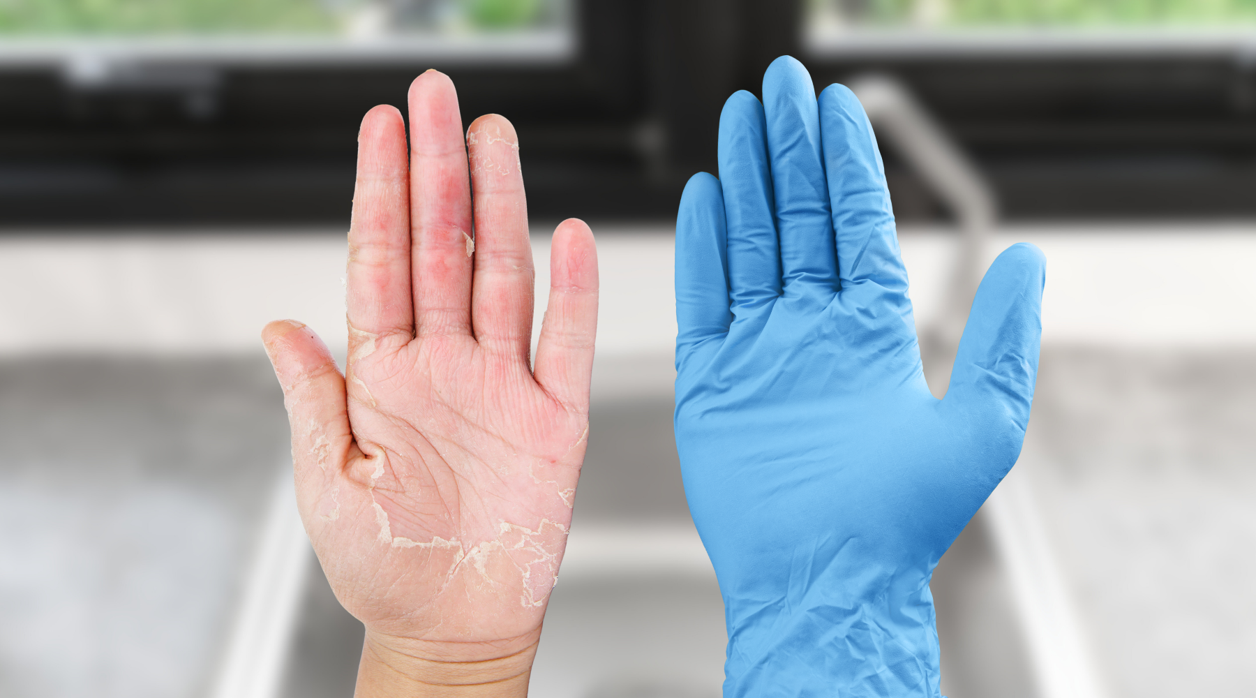 Why Gloves Are Making Your Hands Dry — and What to Do About It