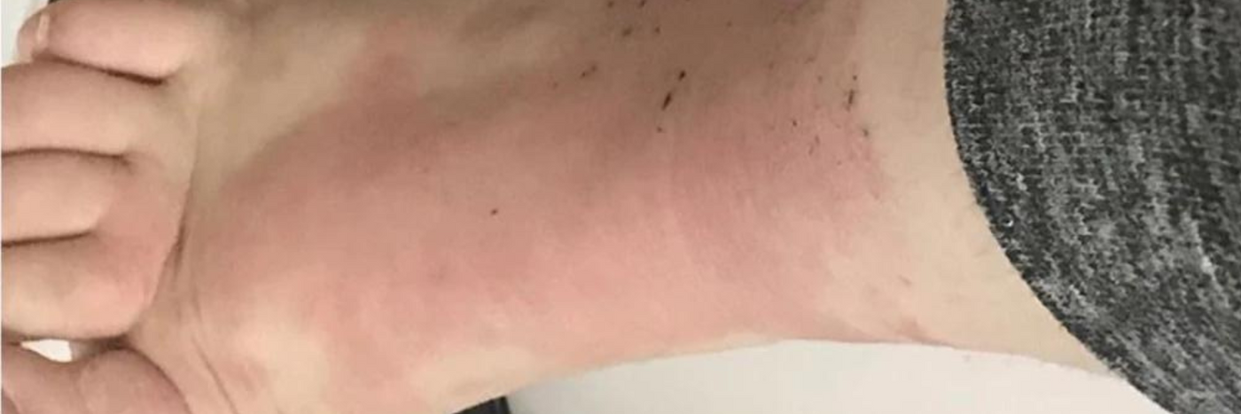 <h2>Before & After using Allay Organics</h2>