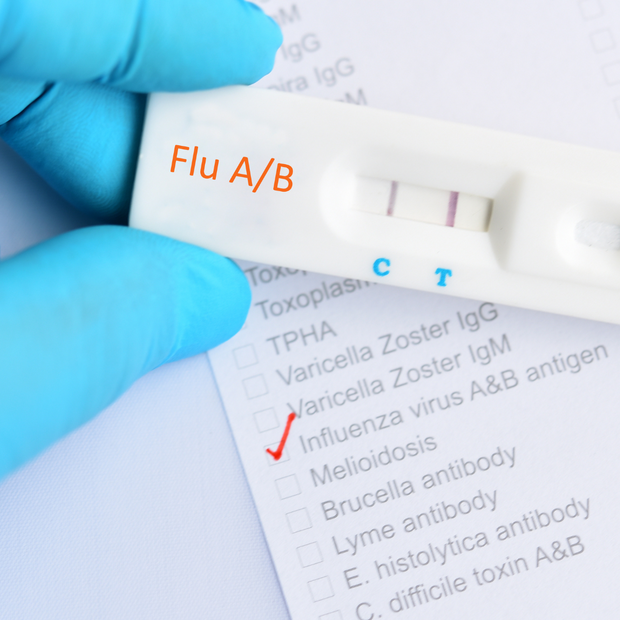 Influenza A/B Rapid Antigen Test